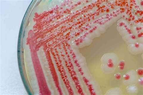 Is Pink Mold Dangerous? - Pink Mold